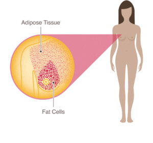 Diagram showing adipose tissue and fat cells in female breasts.