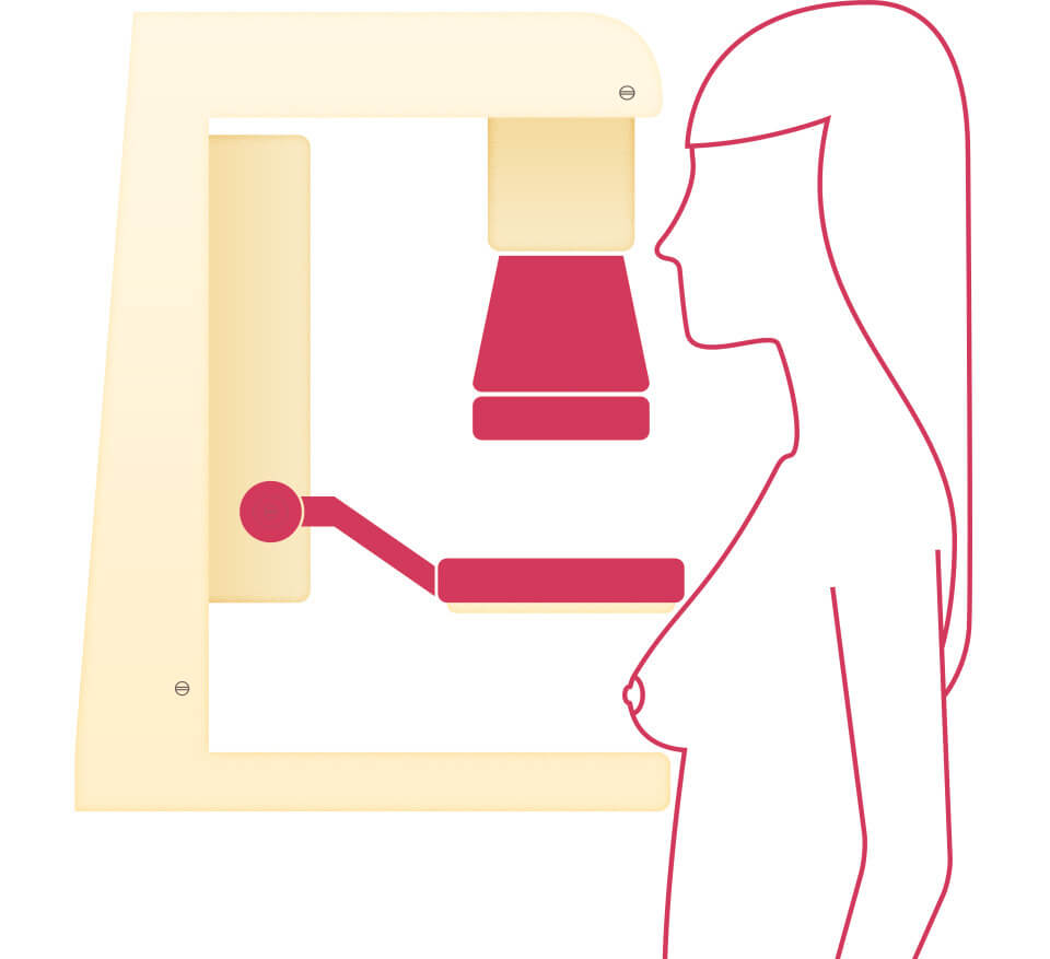 Illustration of a silhouette of woman standing next to a diagnostic mammogram x-ray machine