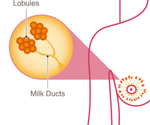 Diagram of a breast showing lobules, lobes, and milk ducts.