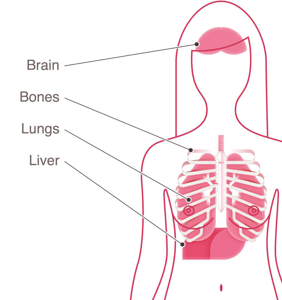 Illustration of female upper body highlighting the brain, bones, lungs and liver areas