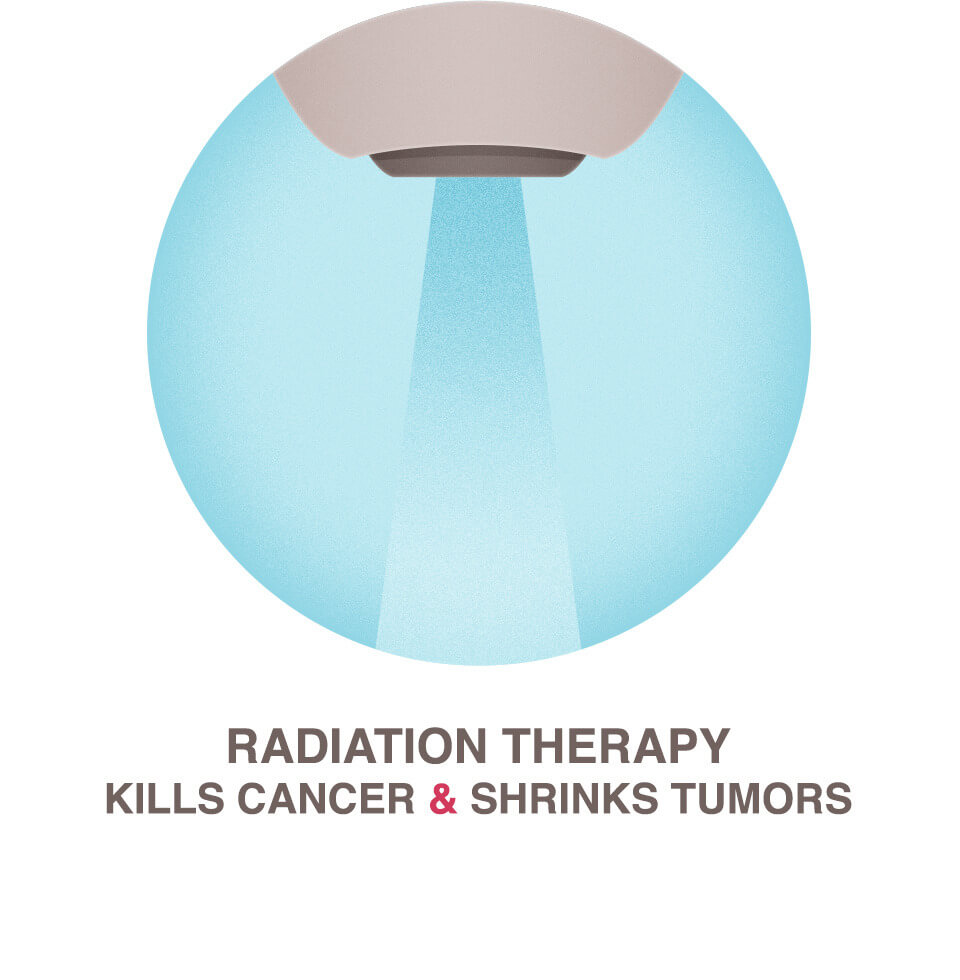Radiation Therapy National Breast Cancer Foundation