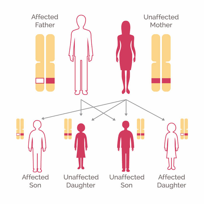 cancer or genetic)